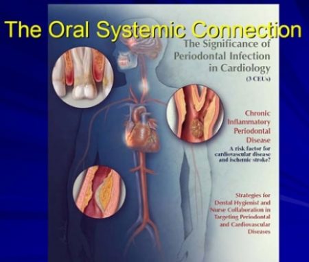 the-oral-systemic-connection
